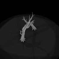 stylized-snowy-dead-tree-archway-451250 — thumbnail 7
