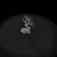 20260612-gnarled-bare-tree-drawing-6001d3929b — thumbnail 6